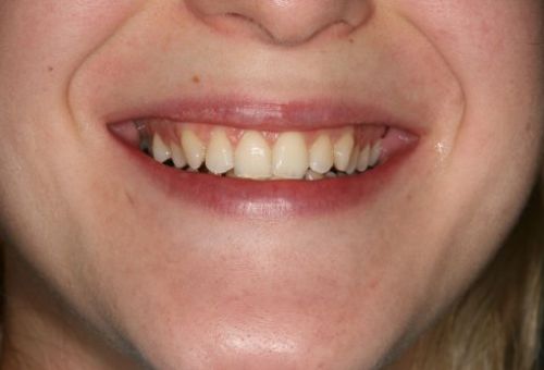 Caso ortodoncia Caso ortodoncia